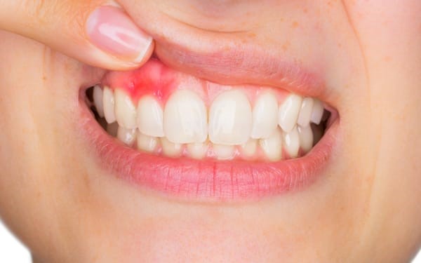 periodoncia