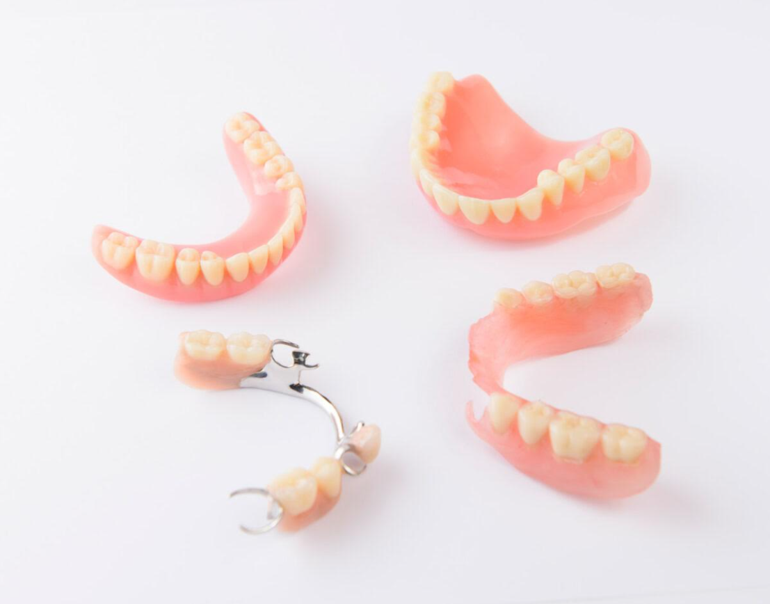 protesis-removible-dental-sosua-2